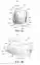 Fig. 09 - Segmented, growth-accommodating, artificial valve