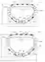 Fig. 01 - Systems and methods for delivery of annuloplasty rings