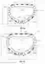 Fig. 02 - Systems and methods for delivery of annuloplasty rings