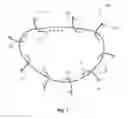 Fig. 12 - Systems and methods for delivery of annuloplasty rings