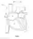 Fig. 15 - Systems and methods for delivery of annuloplasty rings