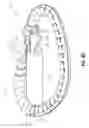 Fig. 20 - Systems and methods for delivery of annuloplasty rings