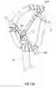 Fig. 25 - Systems and methods for delivery of annuloplasty rings