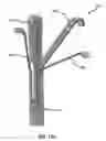 Fig. 26 - Systems and methods for delivery of annuloplasty rings
