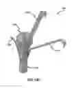 Fig. 27 - Systems and methods for delivery of annuloplasty rings