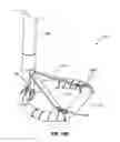 Fig. 35 - Systems and methods for delivery of annuloplasty rings