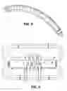 Fig. 05 - Systems and methods for magnetic induction of a penile prosthesis