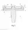Fig. 06 - Tibial Component for a Knee Endoprosthesis with Two PE Liners
