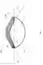 Fig. 10 - CONICAL PATELLA RESURFACING