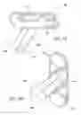 Fig. 05 - SPINAL LATERAL IMPLANT