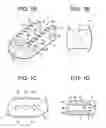 Fig. 02 - Composite vertebral spacers and instrument