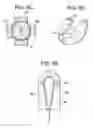 Fig. 17 - Composite vertebral spacers and instrument
