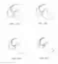 Fig. 19 - Systems and methods for providing a femoral component