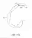 Fig. 43 - Systems and methods for providing a femoral component