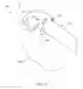 Fig. 64 - Systems and methods for providing a femoral component