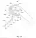 Fig. 65 - Systems and methods for providing a femoral component