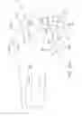 Fig. 74 - Systems and methods for providing a femoral component