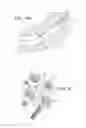 Fig. 07 - Robotic system for shoulder arthroplasty using stemless implant components