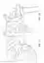 Fig. 08 - Robotic system for shoulder arthroplasty using stemless implant components