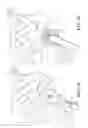 Fig. 09 - Robotic system for shoulder arthroplasty using stemless implant components