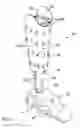 Fig. 02 - Lower limb prosthetic device