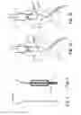 Fig. 02 - Treatment device for aneurysms preferably of aortic kind