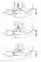 Fig. 03 - Treatment device for aneurysms preferably of aortic kind