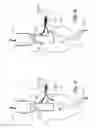 Fig. 04 - Treatment device for aneurysms preferably of aortic kind