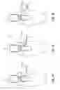 Fig. 05 - Treatment device for aneurysms preferably of aortic kind