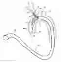 Fig. 01 - METHODS FOR PLACING A STENT IN A BRANCHED VESSEL