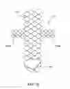 Fig. 05 - METHODS FOR PLACING A STENT IN A BRANCHED VESSEL