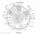 Fig. 14 - METHODS FOR PLACING A STENT IN A BRANCHED VESSEL