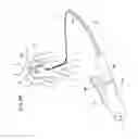 Fig. 20 - METHODS FOR PLACING A STENT IN A BRANCHED VESSEL