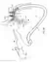 Fig. 22 - METHODS FOR PLACING A STENT IN A BRANCHED VESSEL
