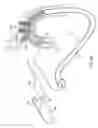 Fig. 23 - METHODS FOR PLACING A STENT IN A BRANCHED VESSEL