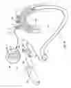 Fig. 24 - METHODS FOR PLACING A STENT IN A BRANCHED VESSEL