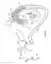 Fig. 25 - METHODS FOR PLACING A STENT IN A BRANCHED VESSEL