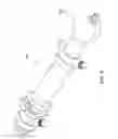Fig. 27 - METHODS FOR PLACING A STENT IN A BRANCHED VESSEL