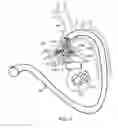 Fig. 29 - METHODS FOR PLACING A STENT IN A BRANCHED VESSEL