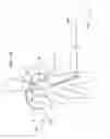 Fig. 30 - METHODS FOR PLACING A STENT IN A BRANCHED VESSEL