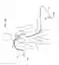 Fig. 31 - METHODS FOR PLACING A STENT IN A BRANCHED VESSEL