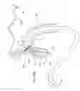 Fig. 34 - METHODS FOR PLACING A STENT IN A BRANCHED VESSEL