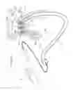 Fig. 35 - METHODS FOR PLACING A STENT IN A BRANCHED VESSEL