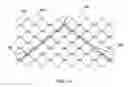 Fig. 37 - METHODS FOR PLACING A STENT IN A BRANCHED VESSEL
