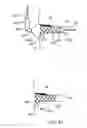 Fig. 43 - Apparatus and methods for delivering stents