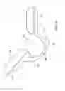 Fig. 05 - Elbow orthosis