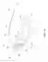 Fig. 15 - Elbow orthosis