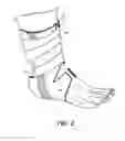 Fig. 03 - ANKLE SUPPORT