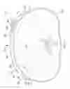 Fig. 04 - Dressing assemblies for wound treatment using reduced pressure
