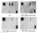 Fig. 01 - Stem Cell-Derived Exosomes Containing a High Amount of Growth Factors